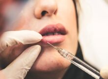 clinica de medicina estetica en barcelona